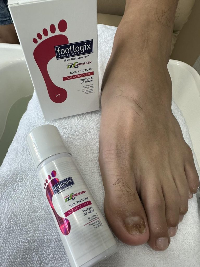 BYYOU ตัวแทนจำหน่ายผลิตภัณฑ์สปาเท้า footlogix