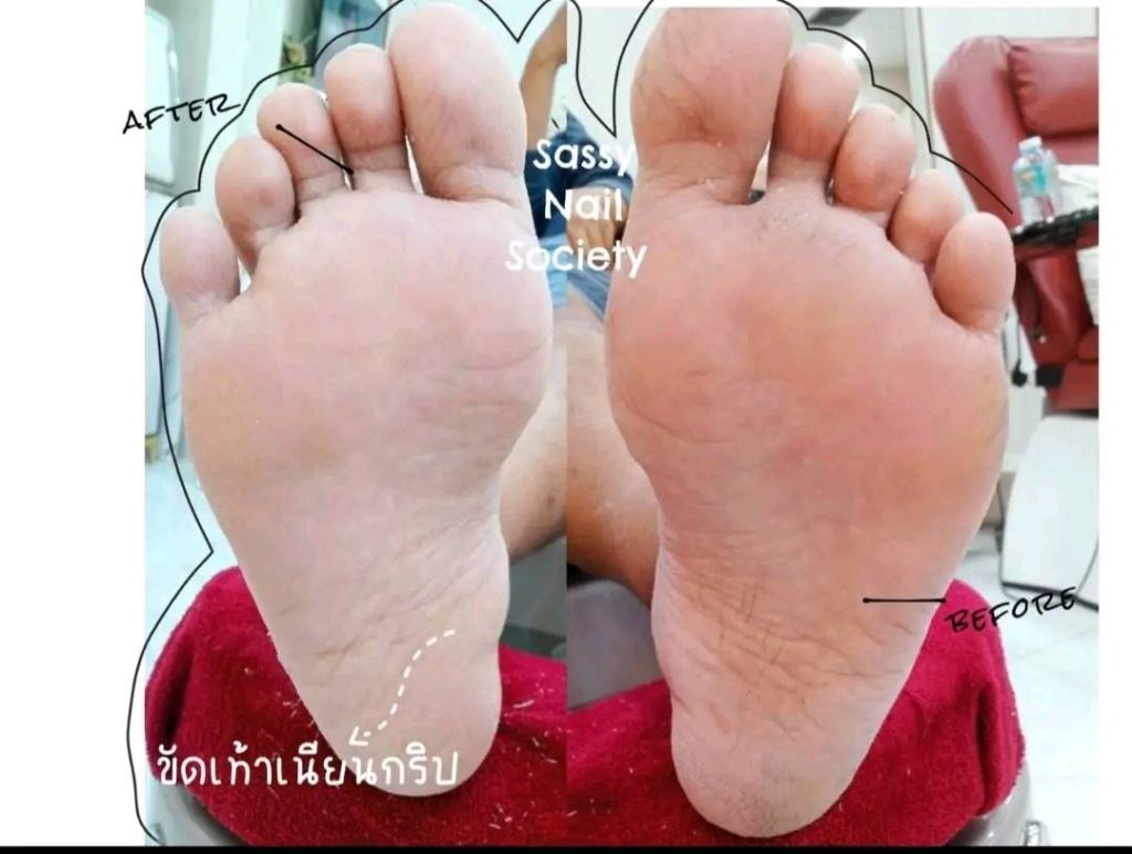 Sassy Nail Arts ตัวแทนจำหน่ายผลิตภัณฑ์สปาเท้า footlogix