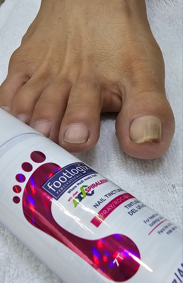 BYYOU ตัวแทนจำหน่ายผลิตภัณฑ์สปาเท้า footlogix