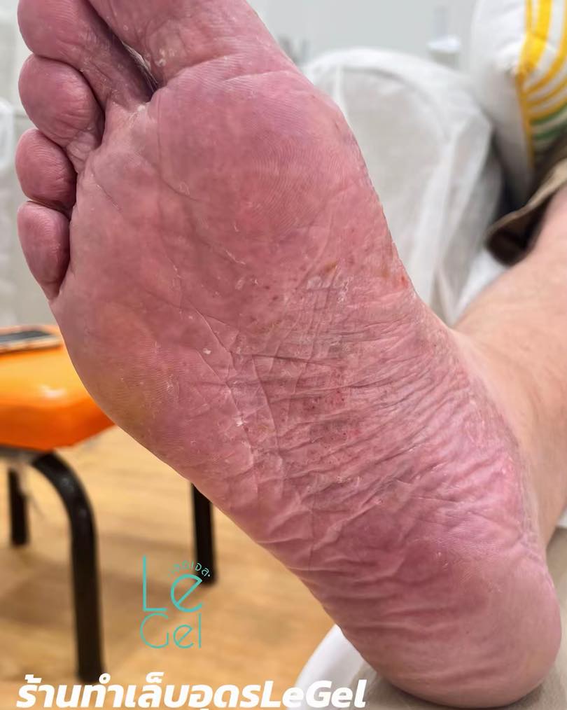 LeGel ตัวแทนจำหน่ายผลิตภัณฑ์สปาเท้า footlogix
