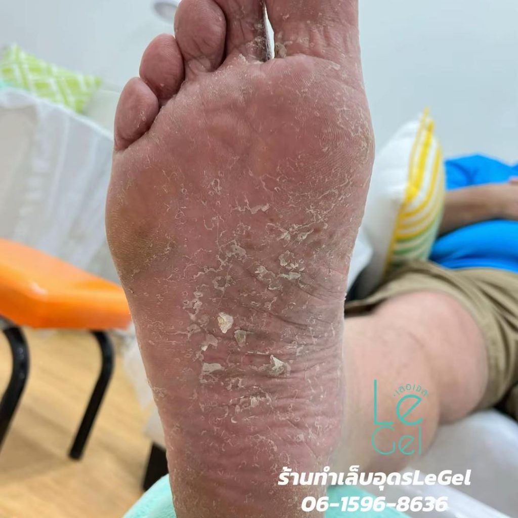 LeGel ตัวแทนจำหน่ายผลิตภัณฑ์สปาเท้า footlogix