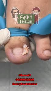 Foot Station ตัวแทนจำหน่ายผลิตภัณฑ์สปาเท้า footlogix