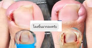 Foot Station ตัวแทนจำหน่ายผลิตภัณฑ์สปาเท้า footlogix