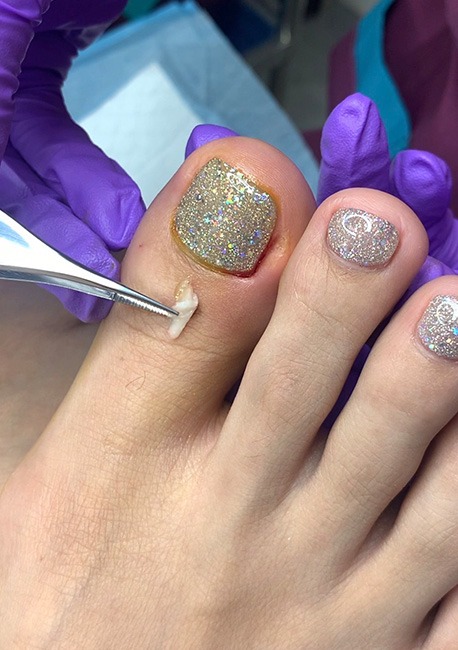 Wefoot ตัวแทนจำหน่ายผลิตภัณฑ์สปาเท้า footlogix