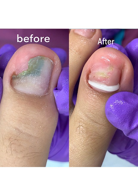 Wefoot ตัวแทนจำหน่ายผลิตภัณฑ์สปาเท้า footlogix