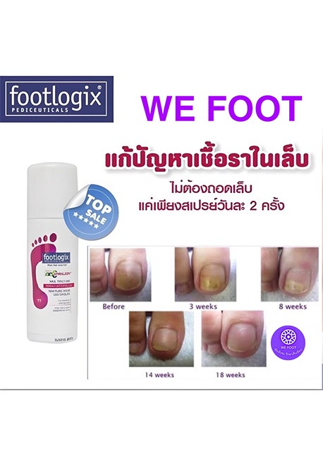 Wefoot ตัวแทนจำหน่ายผลิตภัณฑ์สปาเท้า footlogix