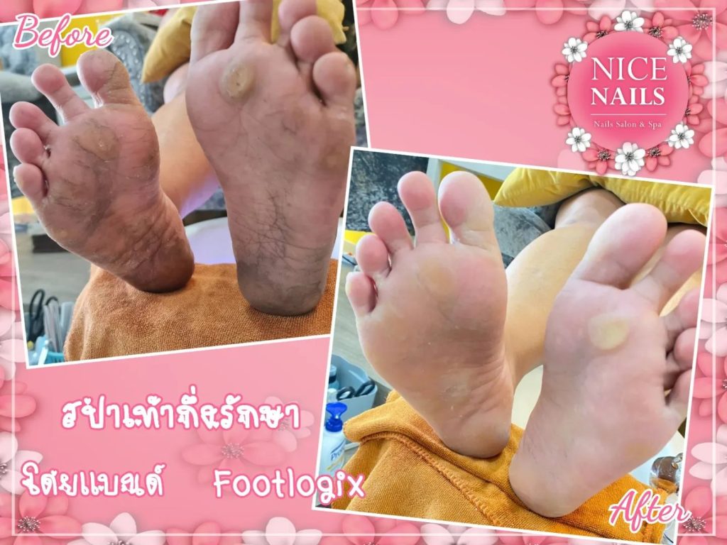 NICE NAILS AND SPA ตัวแทนจำหน่ายผลิตภัณฑ์สปาเท้า footlogix