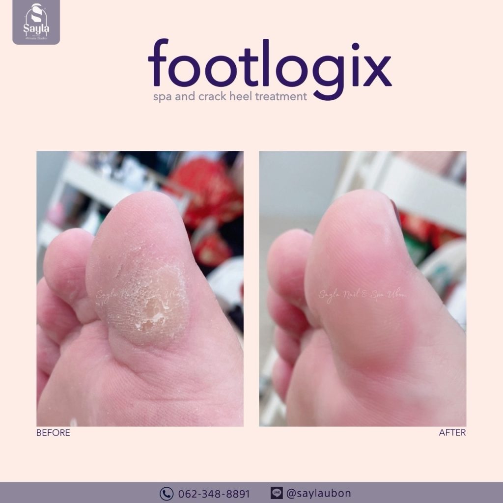 Sayla nails spa ตัวแทนจำหน่ายผลิตภัณฑ์สปาเท้า footlogix