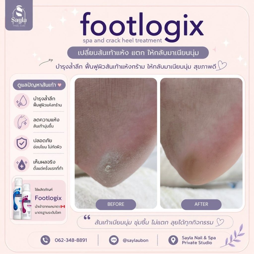 Sayla nails spa ตัวแทนจำหน่ายผลิตภัณฑ์สปาเท้า footlogix